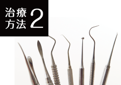 治療方法2